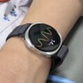 ‘A personal, instantaneous doctor integrated into their devices’ — how a new skin computer patch could run life-saving AI processes directly on your body