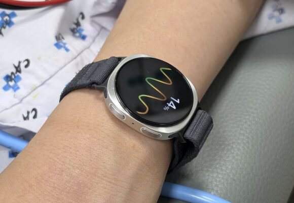 ‘A personal, instantaneous doctor integrated into their devices’ — how a new skin computer patch could run life-saving AI processes directly on your body
